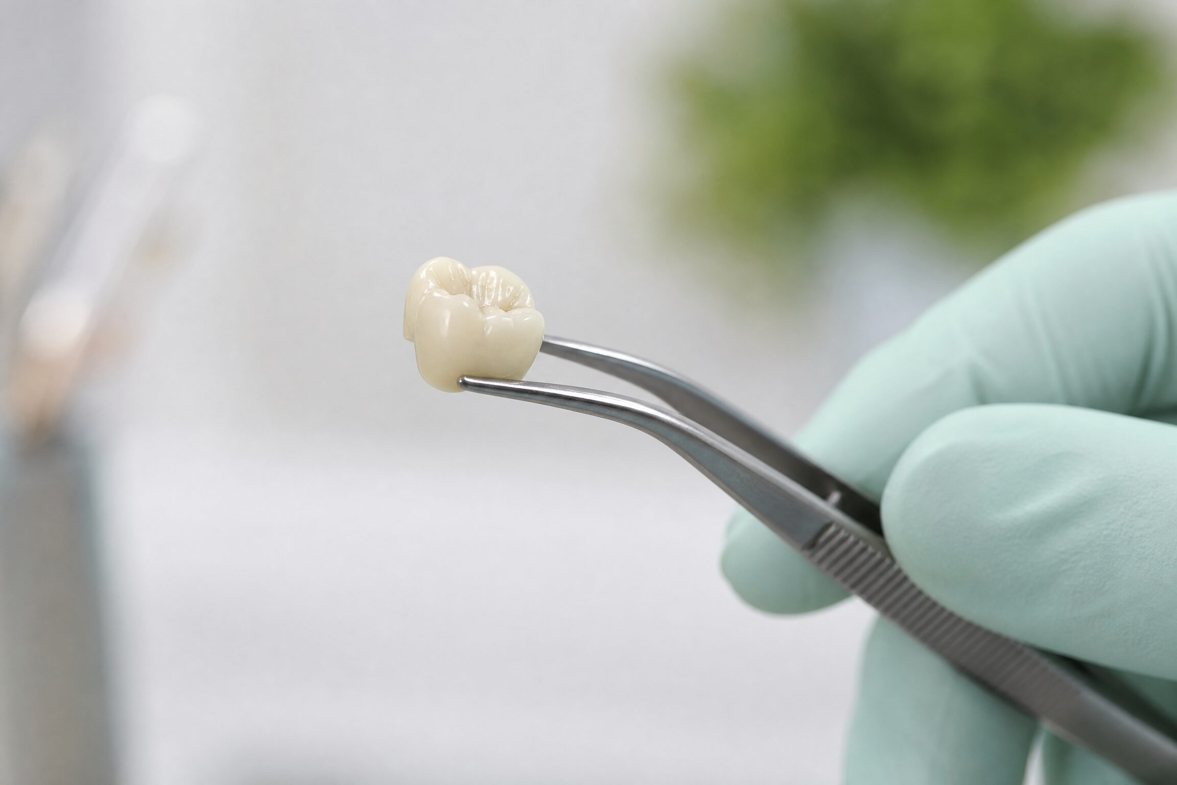 Zirconia Crowns