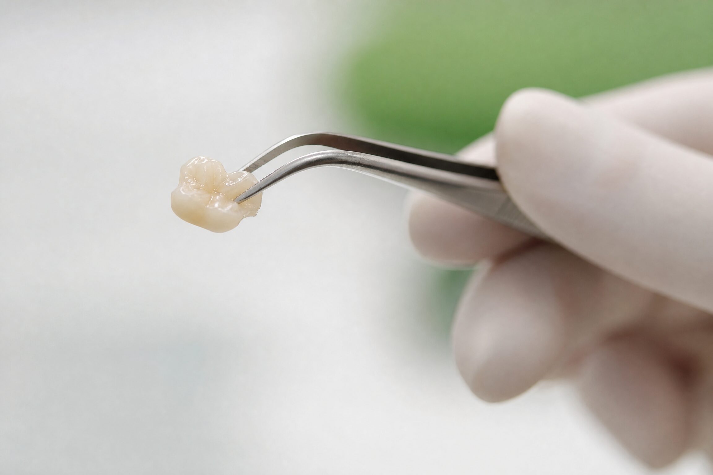 Dental Inlays